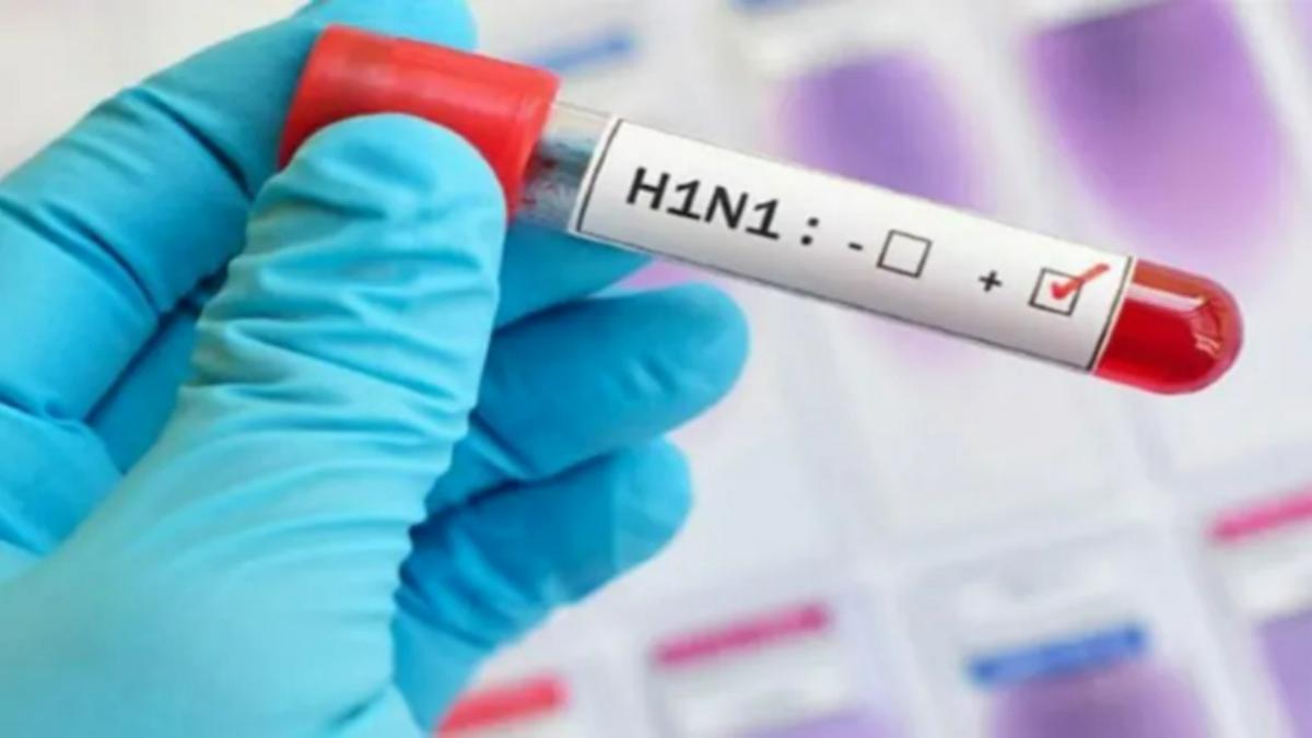 H1N1