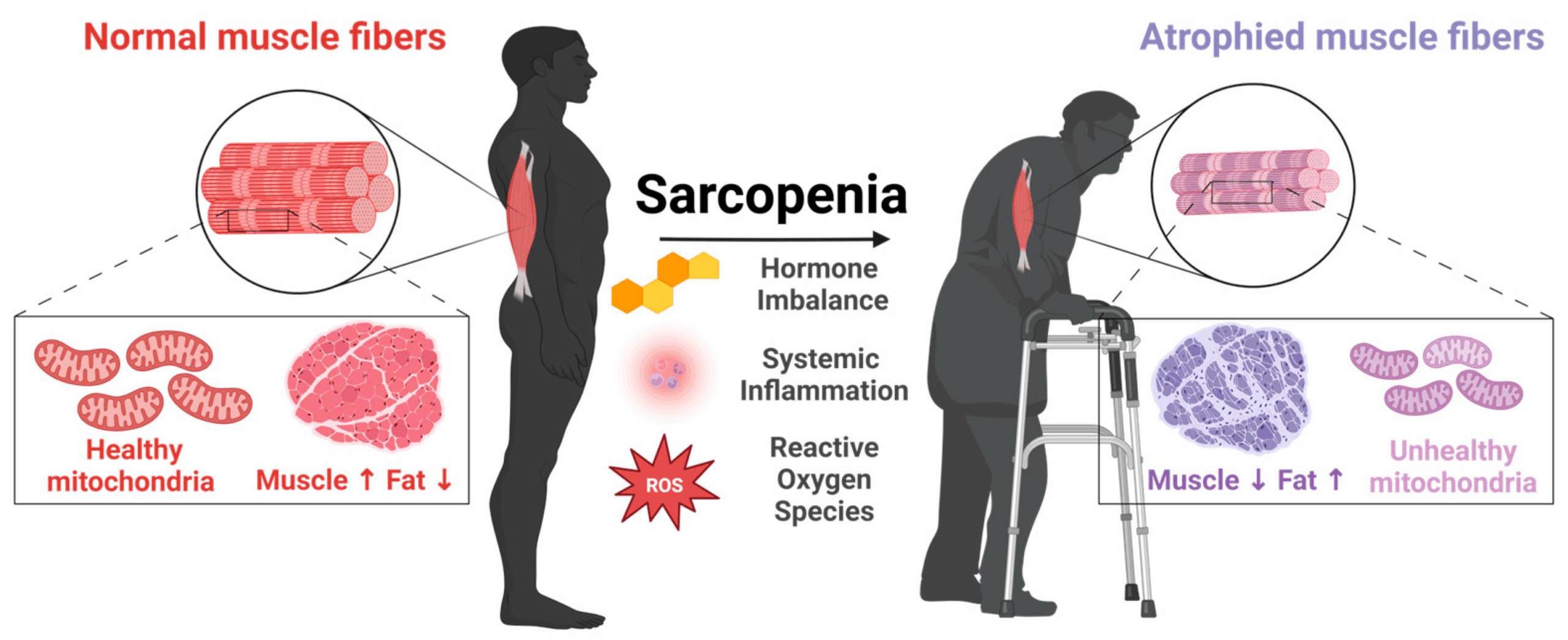 Severe Sarcopenia Components