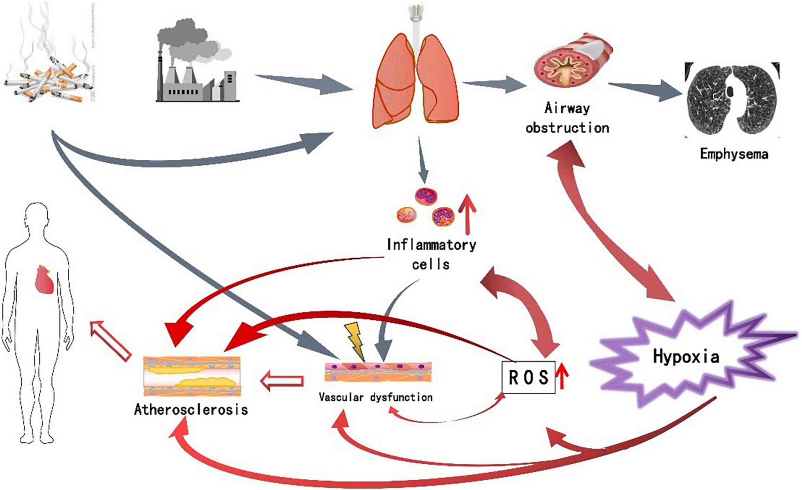 COPD Respiratory Failure
